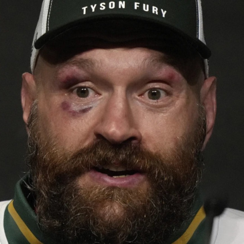 Tyson Fury